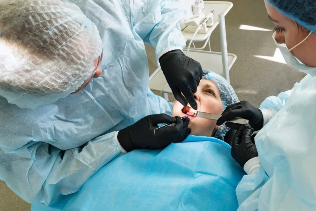 Tooth Extraction